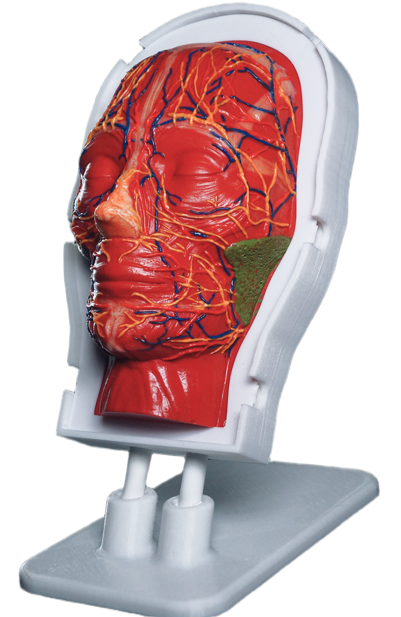 сосуд сбоку